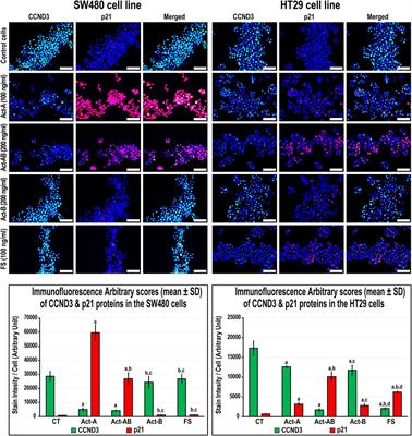 Profiling Activins and Follistatin in Colorectal Cancer According to Clinical Stage, Tumour Sidedness and Smad4 Status